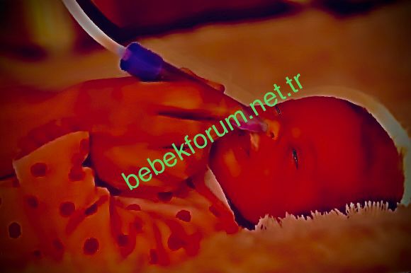 bebeklerde burun tıkanıklığı ve temizliği.jpeg