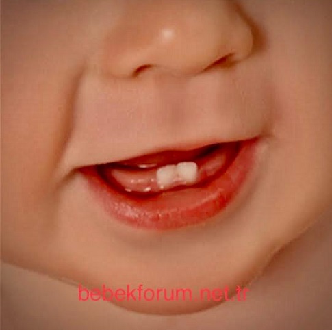 Bebeklerde Diş Çıkarma Dönemi Problemleri ve Ufak Öneriler.jpeg