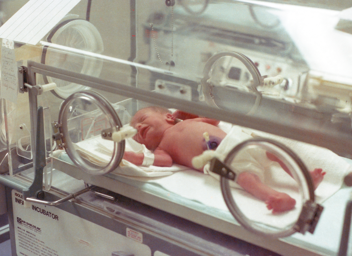 Preterm vs Premature Baby Definitions What’s the Difference-2783728738.png