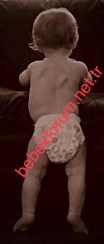 Scoliosis Disease in Children.jpeg