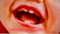 Teething Problems in Babies and Small Suggestions.jpeg