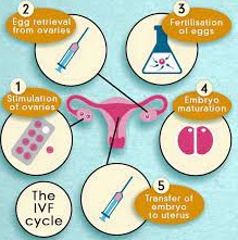 test tube baby process.jpg